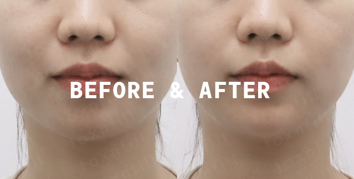 Before & After