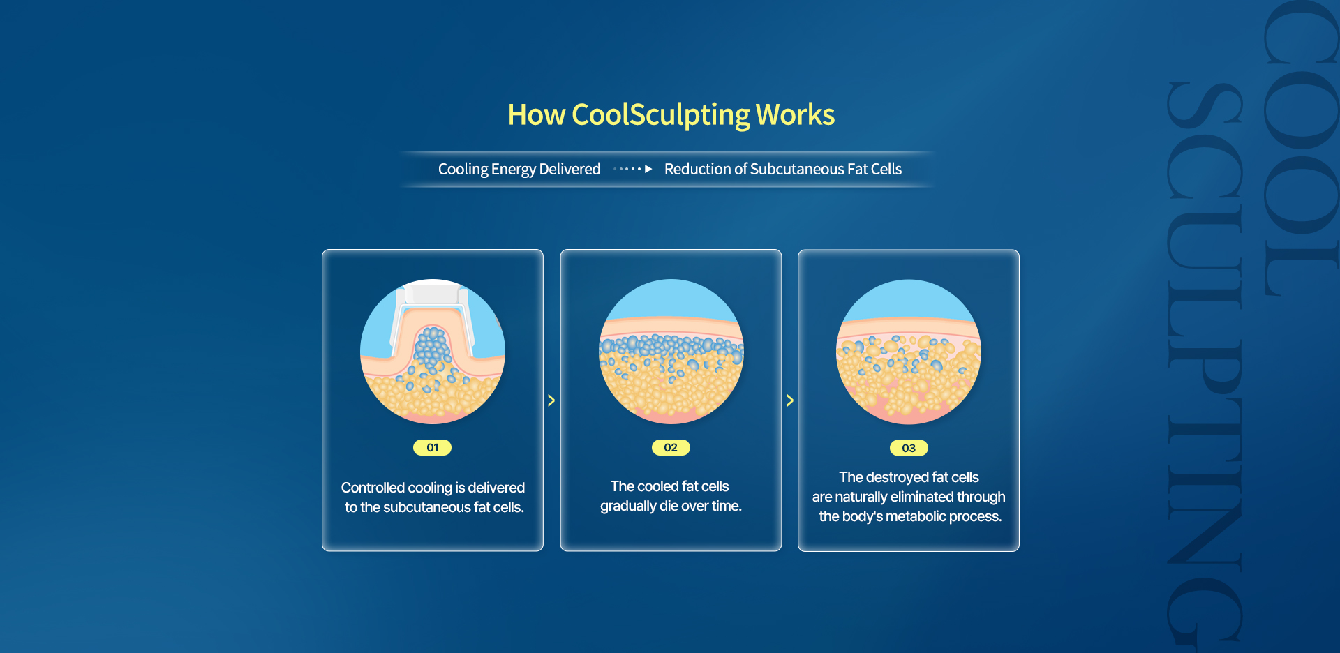 zeltiqCoolsculpting