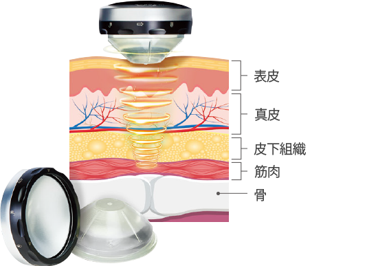 라페라
