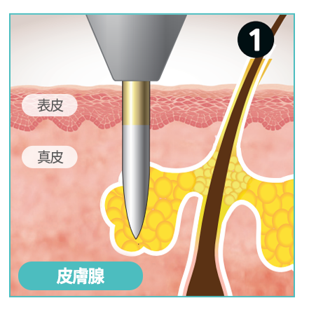 표피, 진피, 피부샘