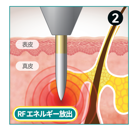 표피, 진피, 피부샘