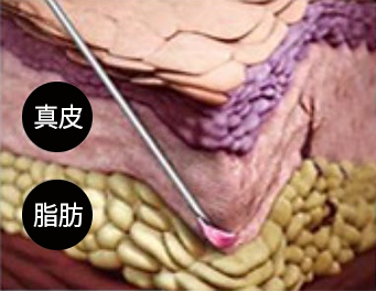 真皮, 脂肪